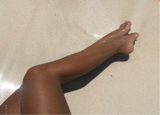 Pure Glow Sunless Tanning for the Partial Body